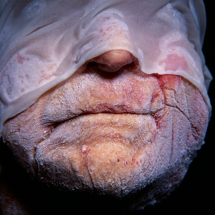 Portrait of a frozen head with frozen mouth